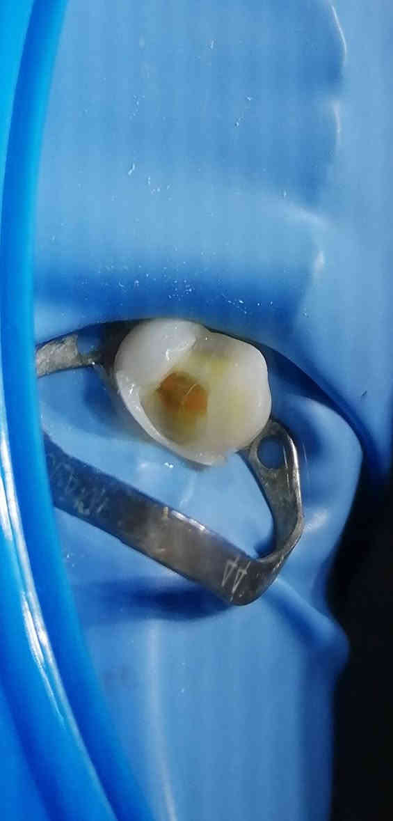 د مهند عبد الجواد... ماجستير تعويض الأسنان.. سايدين مستشفى القياره.. مقابل باب الطوارى الرئيسي.. مجاور صيدليه عبدالله المعماري.. طابق ارضى. ***********#
