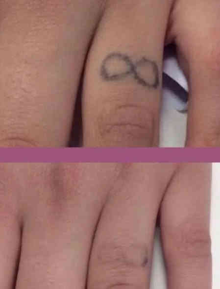 مستعدون لازالة جميع انواع الوشوم القديمة والحديثة بآحدث الأجهزة 
البصرة الجمهورية شارع الاطفاء مقابل ريتاج سنتر قرب حسينية البتول عليها السلام 
*********** البصرة
