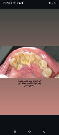 جامعة الكنوز • كلية طب الأسنان • الجبيلة