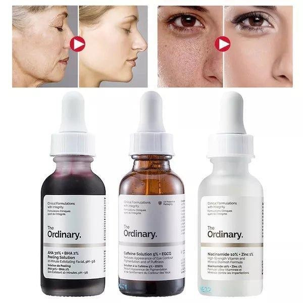 هذا المنتج هو مجموعة العناية بالبشرة The Ordinary Vico Skincare Trio التي تضم ثلاثة سيرومات مختلفة لمعالجة مشاكل البشرة المتعددة. 

تتكون المجموعة من سيروم نياسيناميد للحد من ظهور البقع والاحتقان، وسيروم كافيين للهالات السوداء والانتفاخ، وسيروم تقشير بأحماض الفواكه لتجديد خلايا البشرة. 

تتميز بتركيبات سريرية فعالة تهدف إلى تحسين ملمس البشرة، توحيد لونها، وتجديد حيويتها. 

بسعر 25 الف دينار


**إذا كنت صاحب هذا الإعلان وتريد حذفه لأي سبب، رجاءا أرسل رسالة إلى الدعم الفني**