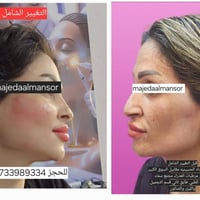 التغيير الشامل يمنه وبس  👄💅   الدكتورة ماجدة المنصور Jojo Alnabeel  ال...