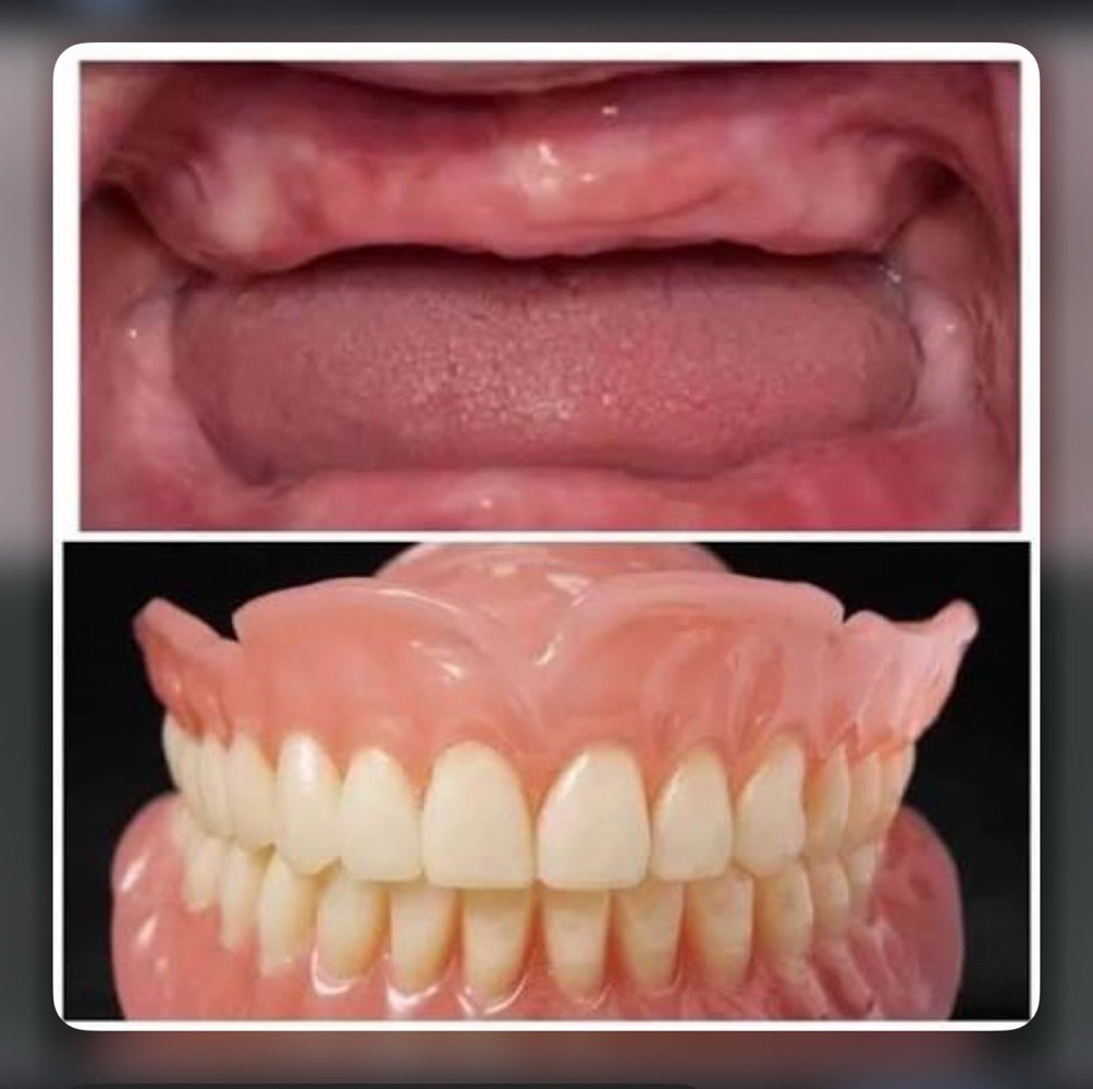  اي شخص محتاج حشوات اماميه او خلفيه او فاقد جميع اسنانه ويحب يعالج بشكل مجاني يتواصل وياي 
بغداد الاعظميه قريب مقبره ملكيه 