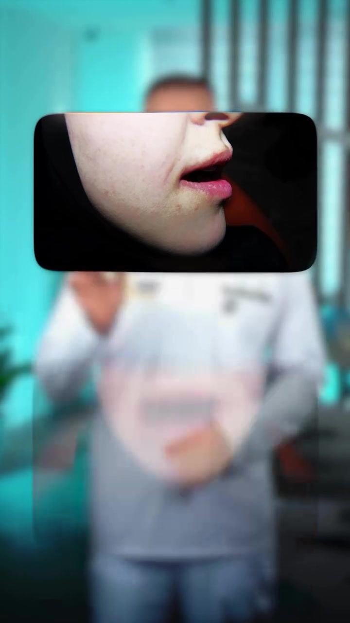 ⁨ ⁨ ⁨ حتى صورها القديمة وذكرياتها كانت ماسحتهم… 
مو لأنها ما تحب الصور، 
بس لأن شكل أسنانها جان يسببلهة انزعاج بكل مرة تشوف نفسها بالمراية. 

تقدم الفك السفلي كان مأثر على ملامحها وثقتها بصورة كبيرة، 
لدرجة كانت رافضة تتصور قبل العلاج… وحقها. 

بس بعد فترة من العلاج، صار الشي اللي فرق وياها فعلاً: 
هي بنفسها گالت 
“دكتور… أريد أصور النتيجة.” ✨ 

لأن الإنسان من يرتاح بابتسامته، 
مو بس شكله يتغير… حتى ثقته بنفسه ترجع. 

وأحلى شعور من المراجع يبتسم بدون ما يحاول يخفي أسنانه 💙 

📍 عيادة رونزا لطب وتجميل الأسنان 
هبهب – قرب المركز الصحي 
📞 ***********⁩⁩⁩
