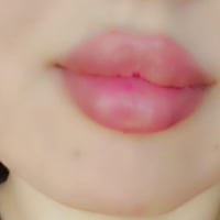 فلر شفايف • دكتورة صابرين • قنطرة كربلاء