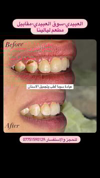 عيادة سوما • طب وتجميل الأسنان • العبيدي