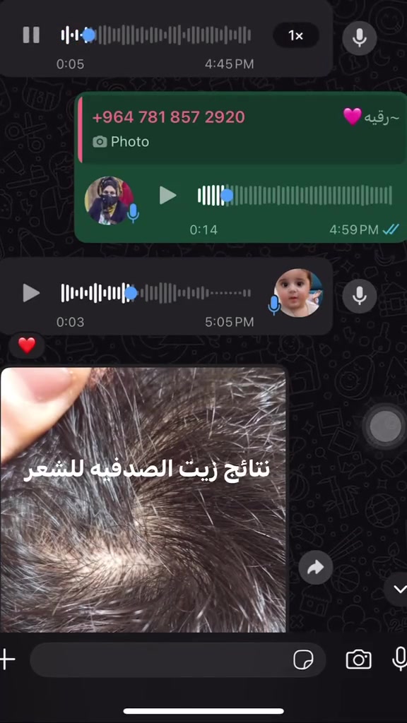 عشبه النيم و تلقب  صيدلية القرية (The Village Pharmacy): هذا هو اللقب الأشهر لها، لأن سكان القرى في الهند يعتمدون عليها منذ آلاف السنين لعلاج معظم الأمراض الجلدية والصحية اليومية. #البصره #الهند #بغداد 


**إذا كنت صاحب هذا الإعلان وتريد حذفه لأي سبب، رجاءا أرسل رسالة إلى الدعم الفني**