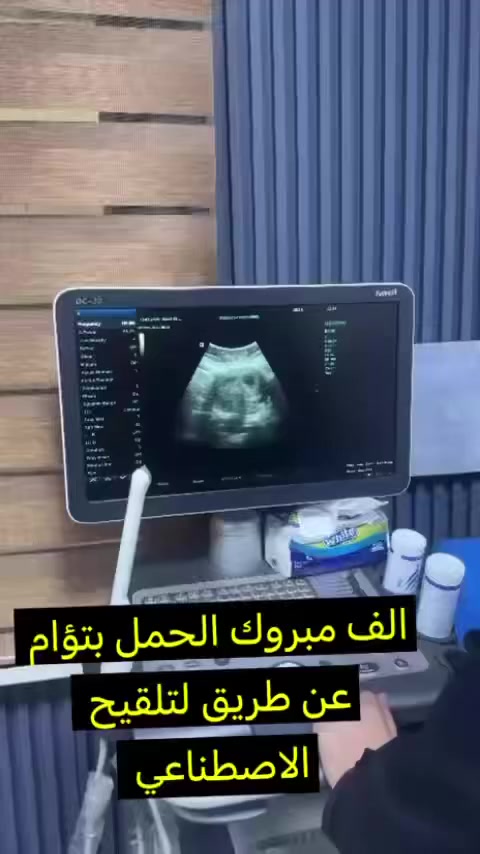 الحمدلله  من أطيب الأخبار 🤍✨
مراجعتي الغالية راجعتني على التلقيح الاصطناعي…
وبفضل الله نجح من المحاولة الاولى 🌸

والمفاجأة الأجمل… رزقها الله بتوأم ♥️
فرحتين بقلب واحد 🤍

اللهم لك الحمد على هالنعمة
اللهم تمم حملها على خير وارزق كل منتظرة نفس هالفرحة 🤍✨

الدكتورة
زمن فرحان محمد
أخصائية النسائية والتوليد والعقم ورعاية الحوامل

للحجز والاستفسار:
📞 ***********
