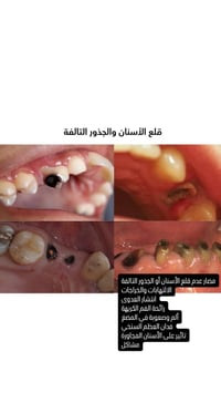 علاج مجاني • عيادات جامعة ابن سينا • جسر الجادرية