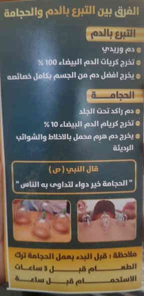 يعلن معشب الدرة للطب التكميلي
عن وجود حجامة احترافية في مكان تواجده في الكرغولية شارع السايد الواحد بالقرب من فلافل علي دبل ولدينا اسعار تنافسية للتواصل اتصل أو راسل الرقم المرفق على الواتساب ***********
