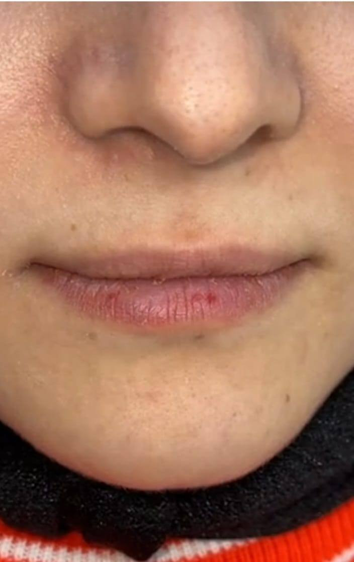 +964 788 968 7846
انواع الوشام ٢٥ الف فقط اما الشعر حسب لطول

بوتوكس وافلر شفة واابرا نظارة  ٦٠ الف فقط

فلر شفة ٣٥ فقط

النهروان خلف مطعم جواد شارع البزل مقابل مولدة ابو دراج ام علي زوجة ابو علي الاسمر
