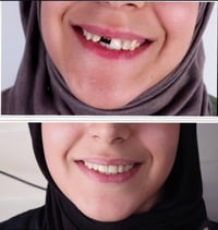 علاج أسنان مجاني • قلع أسنان • حلة شارع 40