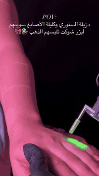 ليزر نسائي • كاترينيا كلينك • المحمودية حي الموظفين