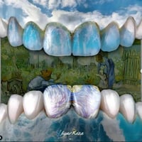 جامعة البيان • علاج اسنان مجاني • حشوات ضوئية