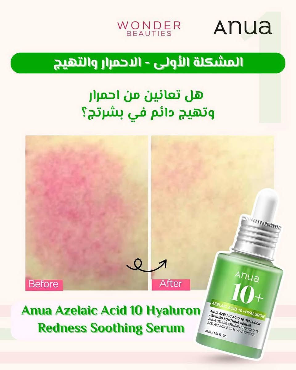 السر وراء بشرة صافية ومشرقة 
 Anua 10+ Azelaic Acid & Hyaluron 
سيروم انوا تركيبة علمية متطورة تعمل على تهدئة البشرة، توحيد لونها، وترطيبها بعمق 

حمض الأزيليك 👇🏻
✅ مضاد قوي للالتهابات، يقلل الاحمرار والتهيجات.
✅ يعمل على تفتيح البقع الداكنة وتقليل التصبغات
✅ يساعد في تقليل نمو البكتيريا المسببة لحب الشباب.
✅ يمنح البشرة ترطيباً مكثفاً بفضل احتوائه على الهيالورونيك اسيد


**إذا كنت صاحب هذا الإعلان وتريد حذفه لأي سبب، رجاءا أرسل رسالة إلى الدعم الفني**