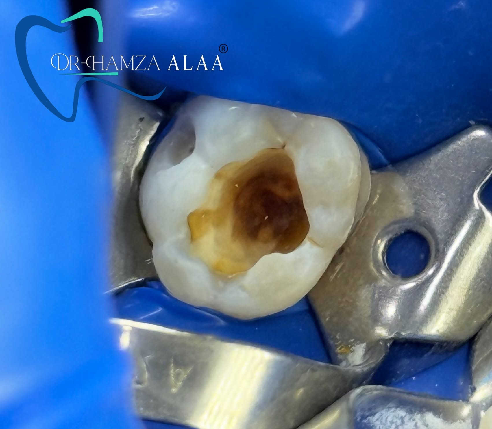 العنوان / بسماية الشارع العام 📍
للحجز والأستفسار مراسلة الصفحة او عن طريق الواتساب ***********📞
