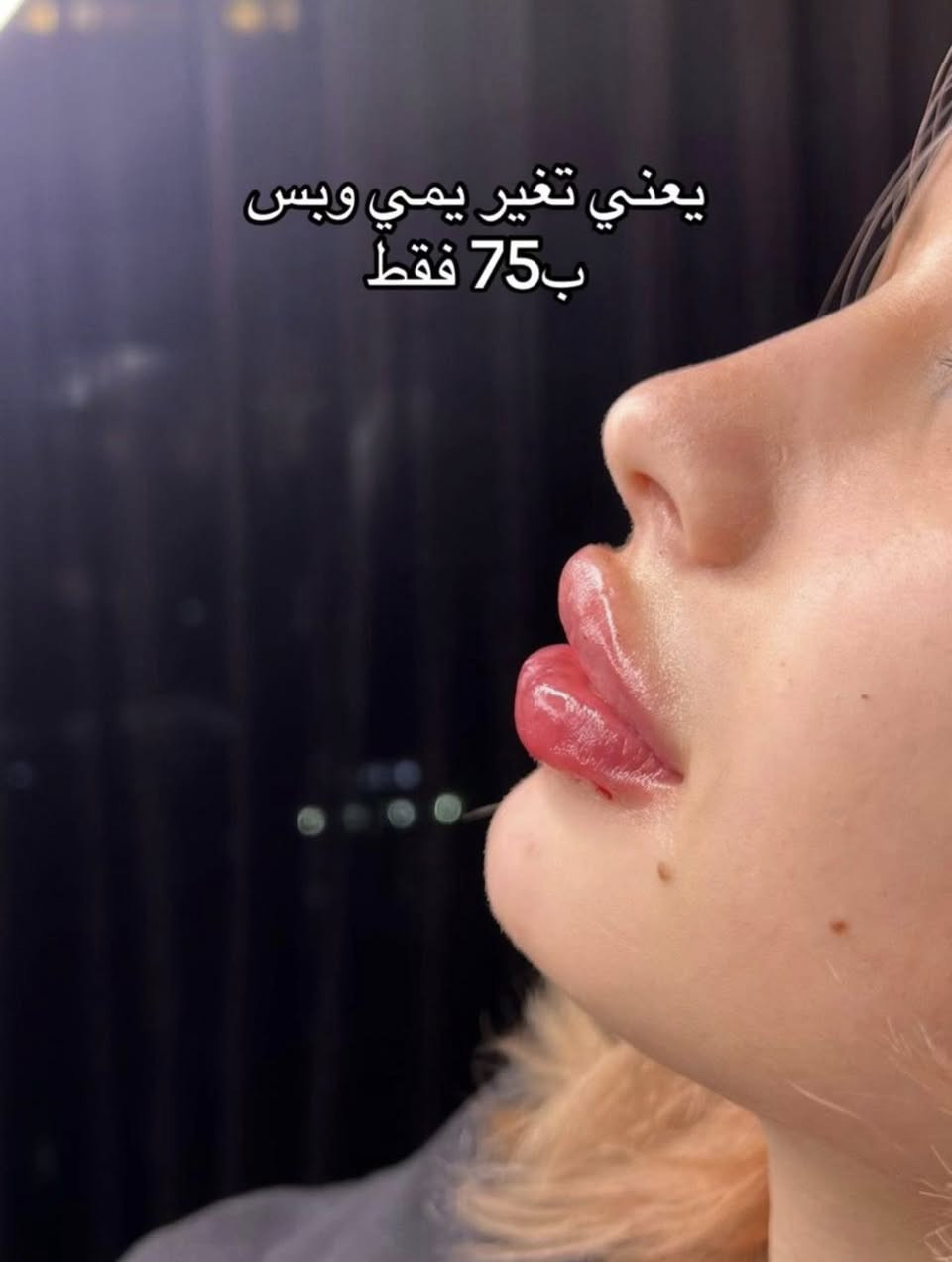 عيادات سنايا للتجميل والليزر وتنظيف البشرة
كربلاء الجمعية 
مقابل مول الحارث
للاستفسار
***********
#فلر #بتوكس #تجميل #بشره #كربلاء
