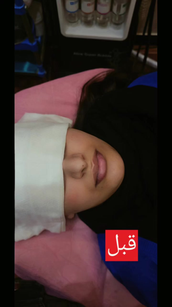 💉 مواد آمنة ونتائج فورية
🌸 مظهر ناعم وشبابي يدوم أطول
 على يد الدكتورة ماجدة المنصور  Jojo Alnabeel 
العنوان بغداد الحسينية مقابل السوق الكبير مجاور مرطبات العذراء
مجمع سما الحسينيه للطابق الثاني قسم التجميل والصالون ***********
