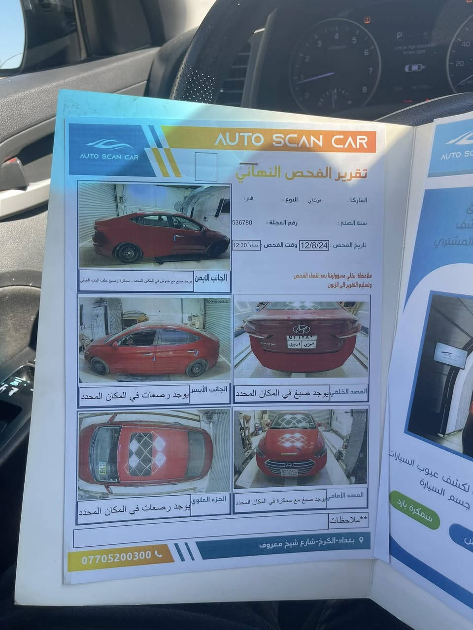 سلام عليكم النترا ١٧ وارد امريكي سياره حادثهه جامغ وباب خلفي وبدلت مكينه مال حاويه وحاليا بيهه راجز واحد مواصفات السياره بصمه فتحه تدفئه كشنات رادار مري ماشيه ١٤٠ صدرهه حلو مكان السياره الطوبجي ***********السعر ١٢٠ بي مجال
