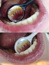 تنظيف اسنان • مجاني • شارع اربعين