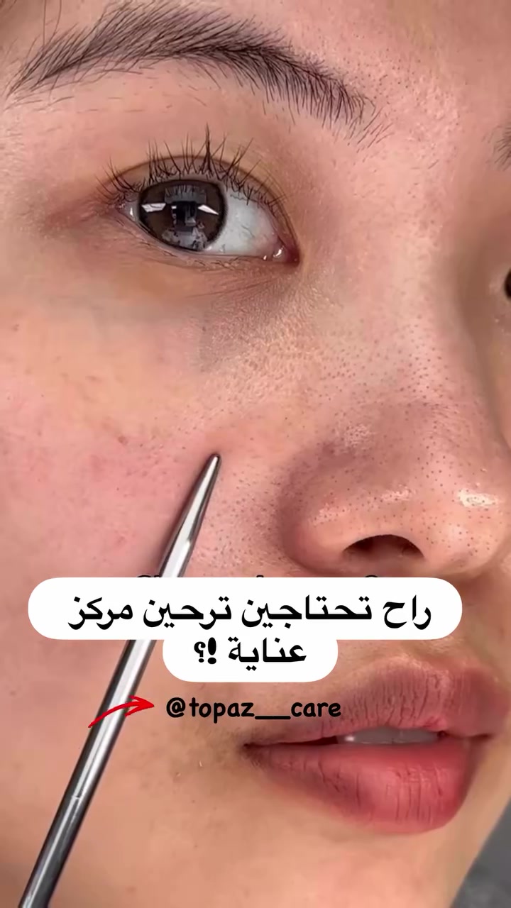 ✨ دكتور ميلاكسين – أمبول تقشير الأرز الأسود ✨

هذا الأمبول راح يفرق وياچ من أول استخدام 👌💜

🧴 تقشير لطيف بدون تهيّج
🖤 يزيل الجلد الميت والشوائب
✨ يقلل الرؤوس السوداء والدهون الزايدة
💧 يحافظ على ترطيب البشرة ويمنع الجفاف
🌸 يعزز إشراقة البشرة ويخليها ناعمة ومخملية
🌿 مناسب حتى للبشرة الحساسة

دلّلي بشرتچ بعناية حقيقية ✨💆‍♀

المنشأ كوريا الأصلي 🇰🇷

يتوفر توصيل لكافة محافظات العراق ب4 الف فقط

#ميلاكسين 
#عنايةبالبشرةكوريا


**إذا كنت صاحب هذا الإعلان وتريد حذفه لأي سبب، رجاءا أرسل رسالة إلى الدعم الفني**
