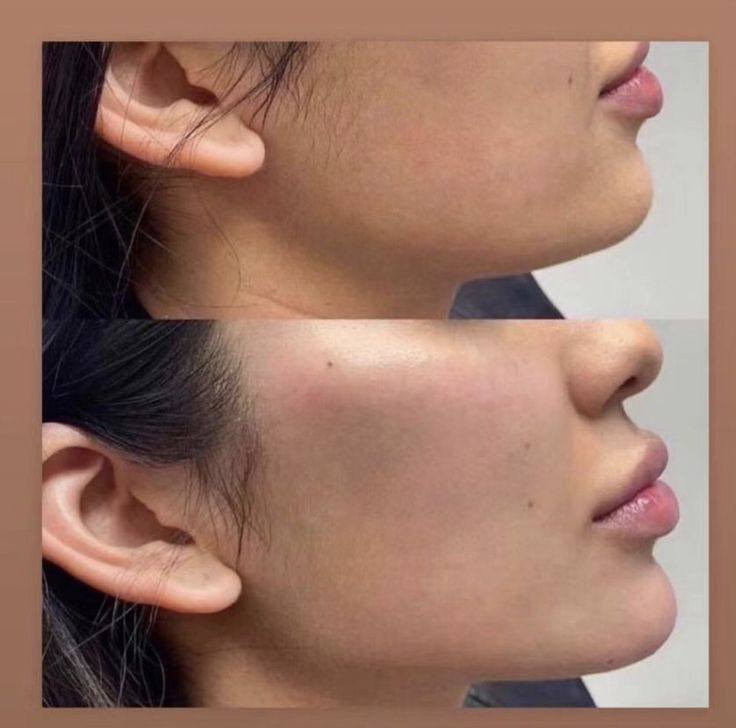 عروض العيد الفطر 
تغير شامل 250الف                                             فلر شفه سعر السيسي 50الف رقم الهاتف ‏‪***********‬‏
