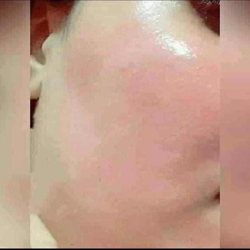 رجعنالكم بقوه 
منا للعيد وجهج يضوي ضوي يعني بعد لا تصبغات ولا هالات ولا وجه شاحب 🫩
وجهج راح يصير كيمر والخدود ورديه☺️👱🏻‍♀️ وأمانة الله وهذا شهر رمضان مابيهه لا درمودين ولا اي عصاره ثانيه 
يعني خلطة مغذيه ومعالجة وماتسبب اي اضرار حته بعد ماتركيهه بداعة رزقي احلفلج حته تاخذين وانتي مأمنه 
السعر 10
السماوه السوق الفوكاني داخل مجمع ابو مهدي محل زهراء العبودي يوجد خدمة توصيل


**إذا كنت صاحب هذا الإعلان وتريد حذفه لأي سبب، رجاءا أرسل رسالة إلى الدعم الفني**