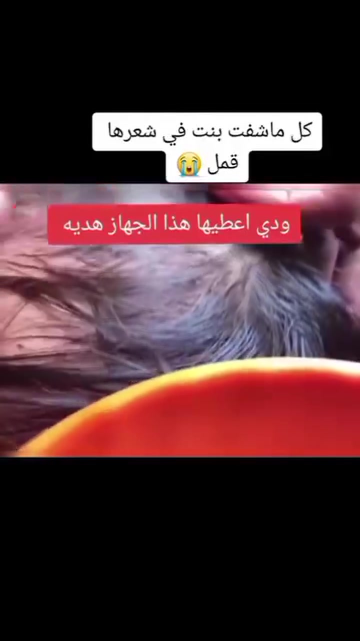 اطفالج بيهم قمل وتعبتي ومتردين تستخدمين  مواد ممكن تأذيهم😳‼️ الحل عندي الج سعرة 25 بي فلاتر تساعدج على شفط االقمل والبيوض وصئبان والقشرة من الرأس بسرعة وبدون تعب وتوصيل مجاني لمدة اسبوع +هدية بسيطة من الكوزمتك ويا طلبج تابعيني وطلبي شمنتظرة🫰‼️‼️

#ازالة_القمل #قمل #صئبان #حشرات_الشعر #شفط_القمل


**إذا كنت صاحب هذا الإعلان وتريد حذفه لأي سبب، رجاءا أرسل رسالة إلى الدعم الفني**