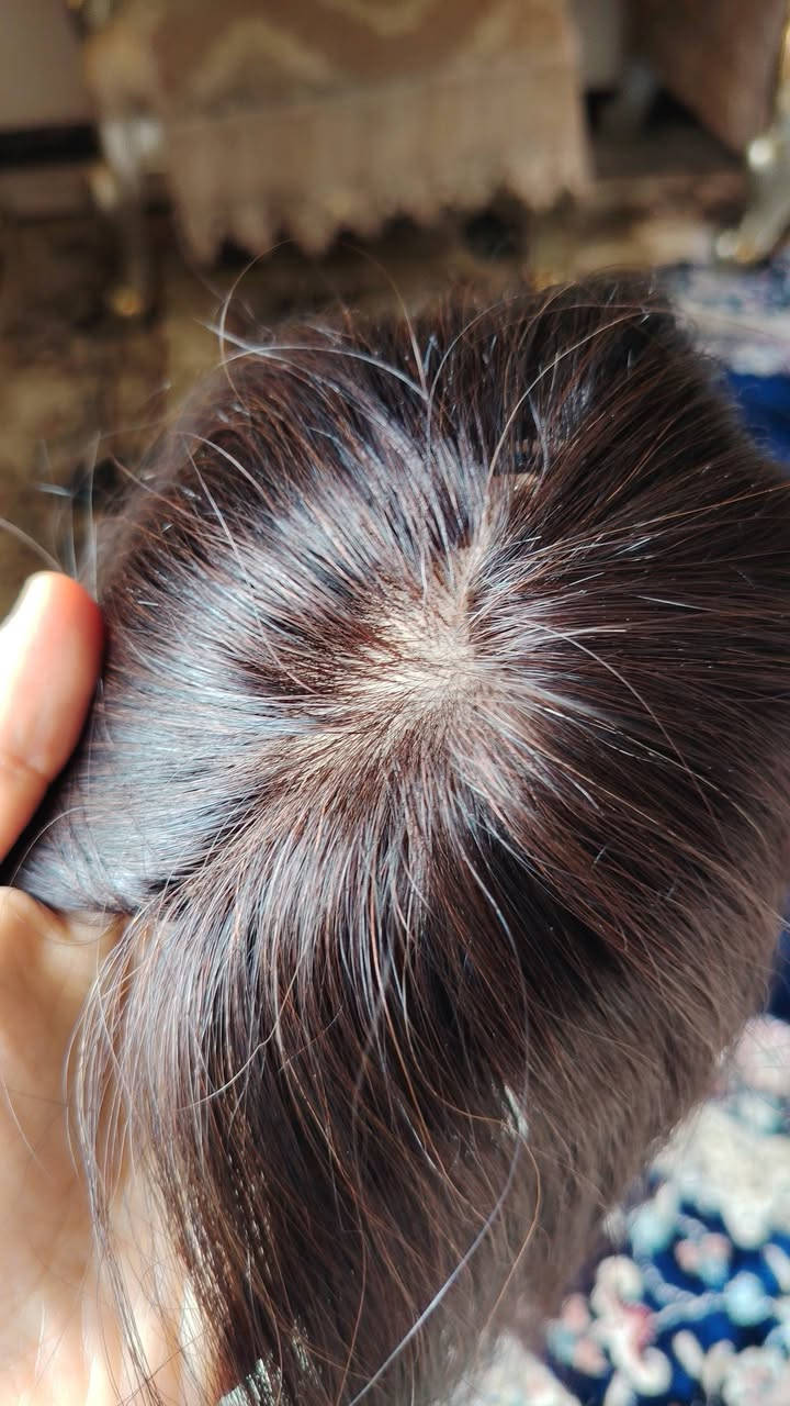 كب شعر طبيعي 100 ٪
الي عدها فراغات بمقدمه الشعر يغطي كلش حلو
ينغسل ويتشسور وينصبغ السعر ١٢٥


**إذا كنت صاحب هذا الإعلان وتريد حذفه لأي سبب، رجاءا أرسل رسالة إلى الدعم الفني**