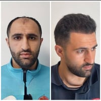 #النتيجه هي المصداق #للنجاح  مع.  #gan clinic غير #حياتك   استغل عروض ...