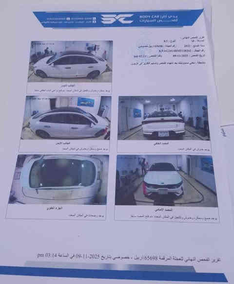 كي فايف K5
‎خليجي موديل 2021 رقم اربيل بيها بارد  بالهلال  الامامي معدل على البارد وشوي من البنيد وصبغ شوي من دعامية كما موضح بالسونار لباقي مكفول كفالة عامة من ظربة والصبغ محرك 2000

مواصفات 

بنراما 

بصمة تشغيل عن بعد 

كامرات 

رادرات

3 انظمة قيادة 

وغيرها من المواصفات المعروفة بالk5

  

سيارة بيها وكالة عامة يعني تتحول بنفس اليوم ماشية113 الف كيلو السعر 195 ورقة رقم صاحبها ***********‏
