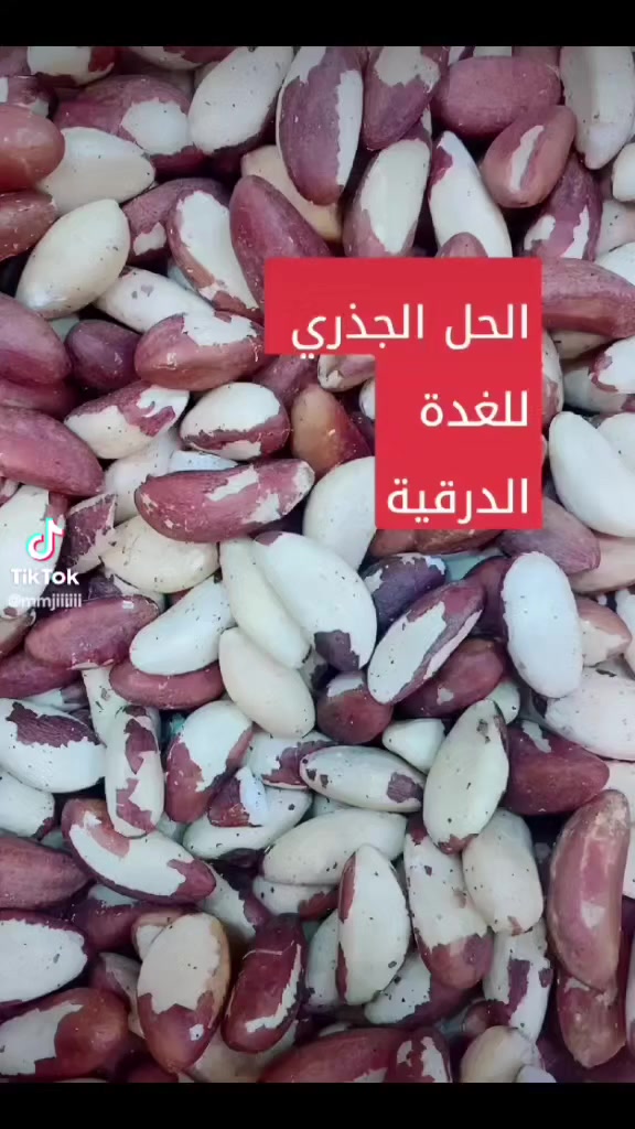 يعتبر اللوز البرازيلي (الجوز البرازيلي) من أفضل المصادر الطبيعية للسيلينيوم، وهو معدن أساسي حيوي للغدة الدرقية؛ حيث يحفز إنتاج الهرمونات، ويحمي خلاياها من التلف والإجهاد التأكسدي. تناول 1-3 حبات يومياً يكفي لتغطية الاحتياج اليومي، مما يدعم التمثيل الغذائي ويخفف من التهابات الغدة الذاتية. فوائد اللوز البرازيلي للغدة الدرقية: إنتاج الهرمونات: السيلينيوم ضروري لتحويل هرمون \(T4\) (غير النشط) إلى \(T3\) (النشط)، مما يضمن عمل الغدة بكفاءة.مضاد للأكسدة: يحمي أنسجة الغدة الدرقية من التلف الناتج عن الجذور الحرة، خاصة في حالات أمراض المناعة الذاتية مثل هاشيموتو.تعزيز المناعة: يساعد في تنظيم الاستجابة المناعية للغدة.الوقاية من الاضطرابات: يقلل من احتمالية قصور الغدة الدرقية الناتج عن نقص السيلينيوم. الكمية الموصى بها:ينصح بتناول حبتين إلى 3 حبات فقط يومياً، لأن الإفراط في تناوله (أكثر من 5-6 حبات) قد يؤدي إلى تسمم بالسيلينيوم. هل تعاني من خمول أم فرط في نشاط الغدة الدرقية، أم ترغب في تعزيز صحتها بشكل عام؟
https://t.me/al_ghanim
محلات وعطارية الغانم
موصل باب السراي
سوق العطارين الرئيسي
#البيع جملة ومفرد
للتواصل والاستفسار
مراسلة الرقم واتساب
***********
