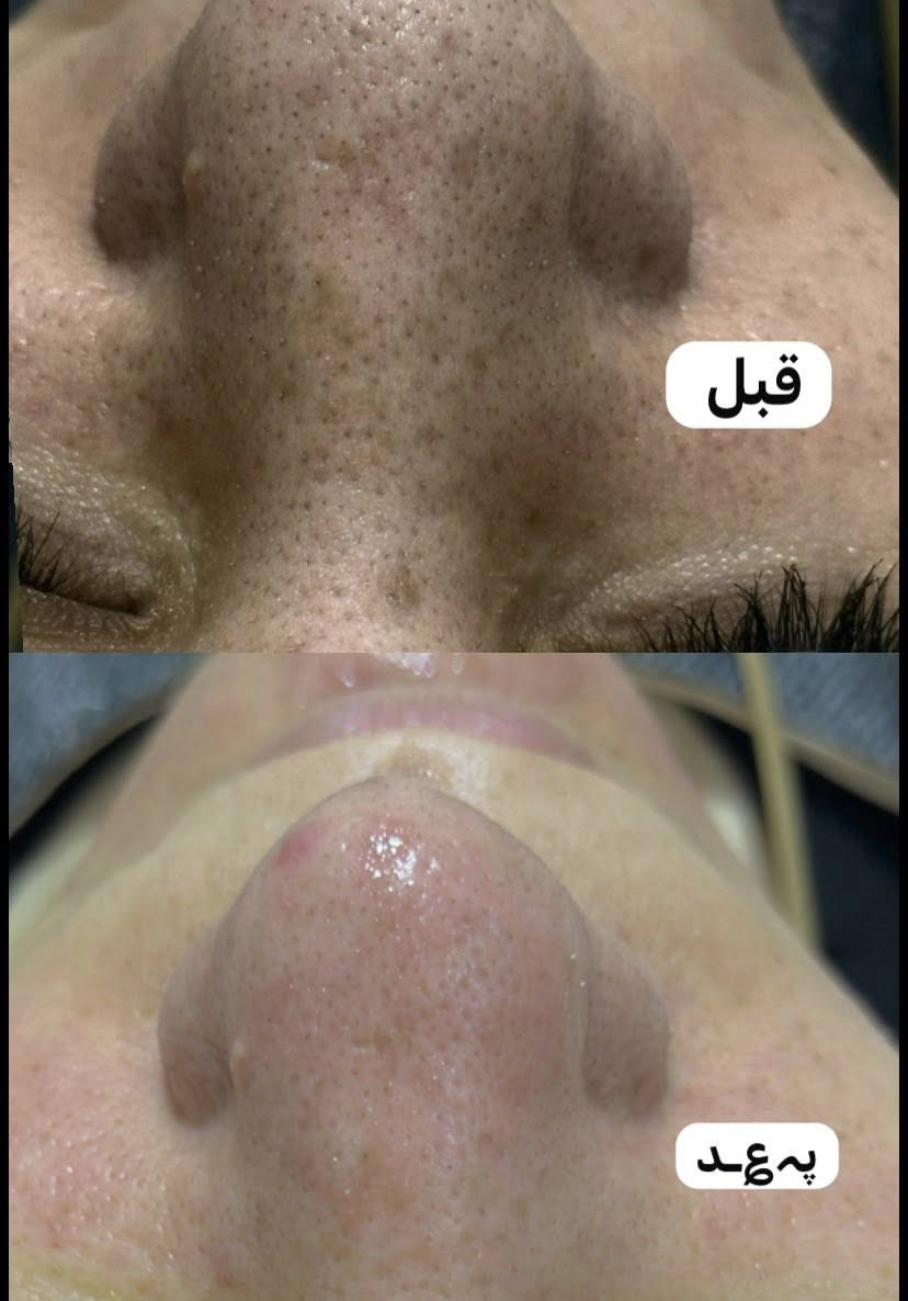 اسرار الجمال من صالون درة🩷
🎀 ديالى بلدروز-مقابل مستشفى بلدروز العام - داخل العمارة الأولى خلف مركز اريدو 
رقم الحجز (***********)
#صالون #مكياج ‎#نصائح  #بلدروز مركز_تجميل  حلاقة_نسائية عروض العيد من صالون درة اسعار مناسبة وشغل يجنن وكل الهلا بزبائنا الكرام
