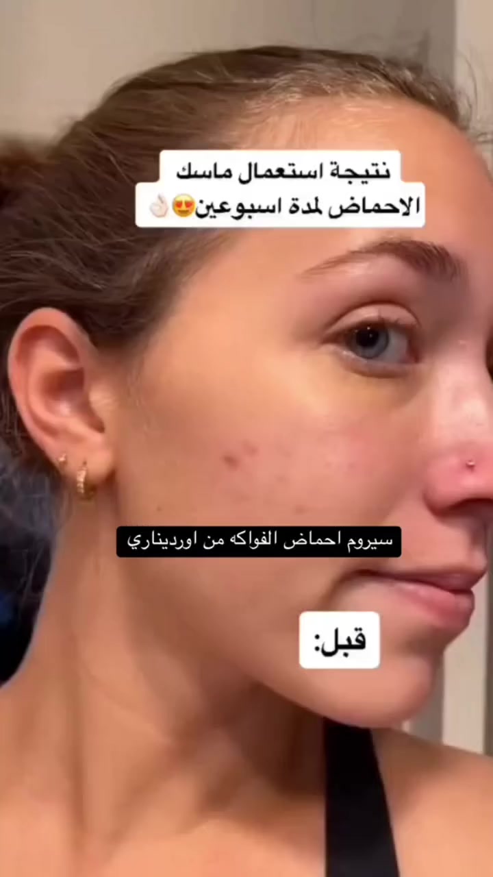 #سيرومات_أوردنري_الأصلية #سيروم_احماض_الفواكه #بشرة_صافية #بنات_العراق #بغداد_بعقوبة_الانبار_البصرة_كركوك_اربيل_الحلة


**إذا كنت صاحب هذا الإعلان وتريد حذفه لأي سبب، رجاءا أرسل رسالة إلى الدعم الفني**