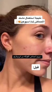 سيرومات أوردنري • احماض فواكه • بشرة صافية