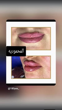 فلر ديلوكس • فلر براند لكوري • فلر ٤–١٠ سيسي