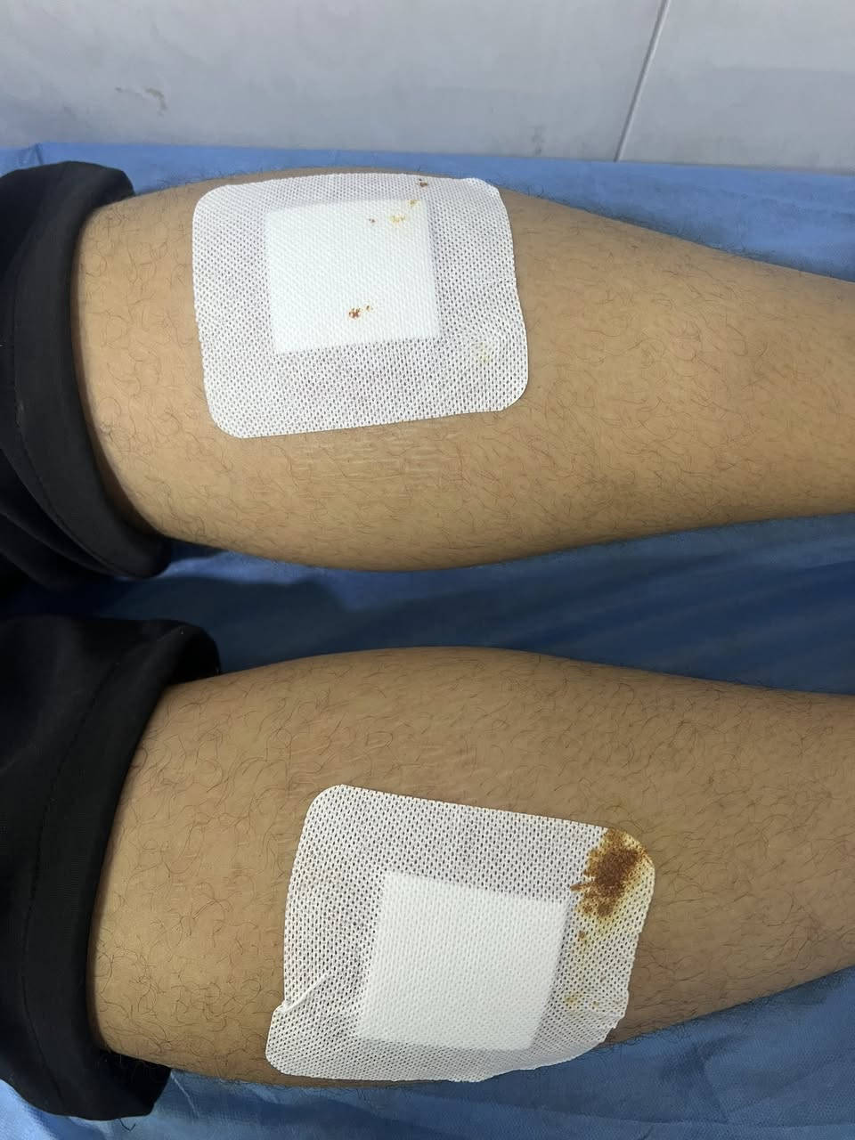 الحجامه النبويه والعلاجيه
. قال رسول الله ﷺ:

«إِنَّ أَمْثَلَ مَا تَدَاوَيْتُمْ بِهِ الحِجَامَةُ»

👉 المعنى: من أفضل وسائل العلاج الحجام

 ✨ الحجامة النبوية – طريقك للصحة والعافية ✨

هل تعاني من:

✔️ صداع مزمن  

✔️ آلام الظهر والرقبة  

✔️ إرهاق وتعب مستمر  

✔️ توتر وقلة نوم  

🔸 الحجامة تساعد على:

✔️ تنشيط الدورة الدموية  

✔️ تخفيف الألم والالتهابات  

✔️ تحسين النشاط والطاقة  

✔️ الاسترخاء وتقليل التوتر  

📌 بإشراف مختصين وبأدوات معقمة 100%  

📌 خدمة آمنة وفق الشروط الطبية  

📍 الموقع: الكرغوليه سايد الواحد مقابيل مول الامراء  

📞 اتصال: ***********  

📲 واتساب: ***********  

زورو الصفحه وتابعو المنشورات والعمل
