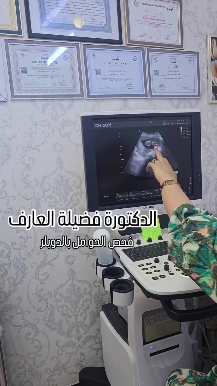 📢 إعلان هام لمراجعي عيادات الوتد الطبية في بسماية 🔴🔴
حرصاً منا على تقديم أفضل الخدمات الطبية والرعاية الصحية المتكاملة، نود إعلامكم بتوفر جهاز الدوبلر السونار الملون (Doppler) الآن داخل عيادة:
👩‍⚕️ الدكتورة فضيلة العارف (اختصاص طب الاسرة_نسائية _رعاية الحوامل _باطنية وجراحة عامه_تغذية علاجية وتجميل)
تنورونا في أي وقت، وأهلاً وسهلاً بجميع المراجعين الكرام. ✨
 📍 العنوان: بسماية - الشارع العام - مجاور صيدلية الوتد ومجمع كلشي رخيص.
 📞 للاستفسار والحجز: ***********
***********
#مجمع_وتد_بسماية_الطبي #الدكتورة_فضيلة_العارف #جهاز_الدوبلر #نسائية_وتوليد #بسماية صحة_المرأة
