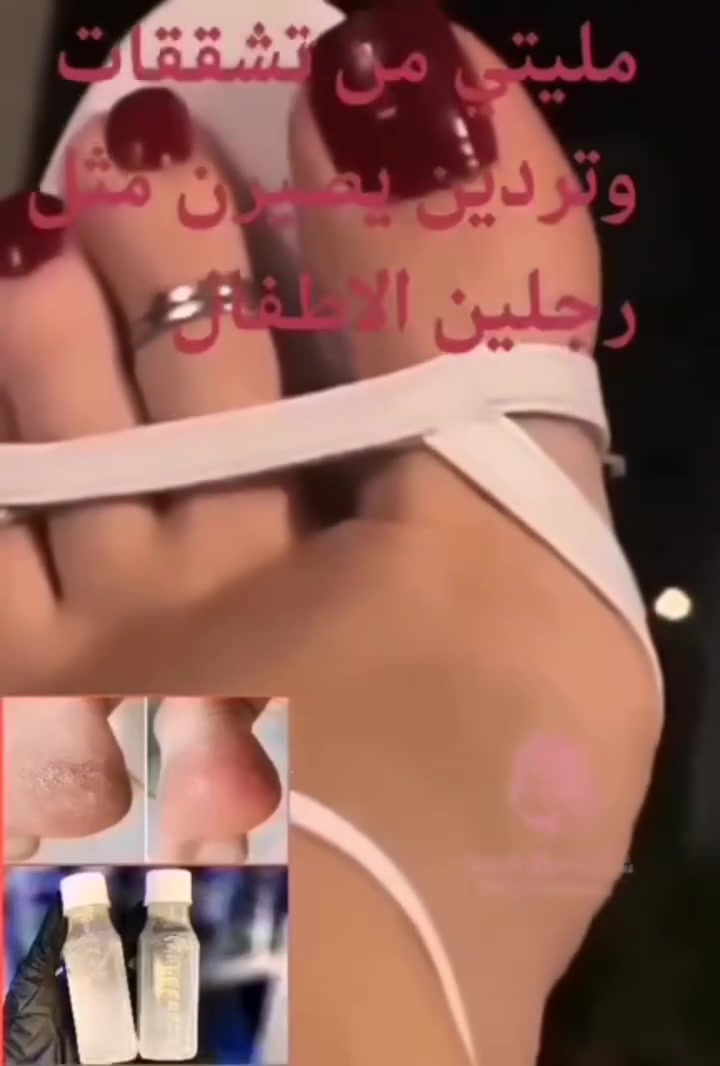 كالوس لازالة الجلد الميت و تشققات القدم
CALLUS REMOVER
ميحتاج تروحين مركز تجميل او صالون توفر منتج ( كالوس ) للقدم تگدرين تشتغليه بالبيت وبكل سهوله ♥️
وضيفته يشيل الجلد الخشن الي بالكعب خلال دقائق 👍✋
مزيل مسامير القدم - قولي وداعًا لتصلب الجلد والجلد الميت. مثل امتلاك باديكير احترافي بدون تكلفة عالية.
القضاء على الناجم في المنزل! - مزيل الجلد الميت هذا للقدمين يعمل خلال 3 إلى 5 دقائق! ببساطة انقع قدميك في حوض الاستحمام أو في حوض قدم، انتظر ثم استخدم أداة تنظيف القدم المفضلة لديك أو حجر خفاف القدم لإزالة مسامير القدم بلطف.
استخدمه مع مقشِّر قدمك المفضل - لا يقتصر على إزالة مسامير القدم فحسب، بل يجعل قدميك ناعمتين وناعمتين للطفل.
قوة احترافية لتوفير الوقت والمال - باديكير يمكن أن تصبح باهظة الثمن. علاجات إزالة مسامير القدم مكلفة بشكل خاص! الآن يمكنك القيام بذلك في المنزل وتوفير المال والوقت بين باديكير. لم يكن الحفاظ على قدميك ناعمة ولينة بهذه السهولة!
يعمل حتى أقوى الكفاءة - إذا كنت تعتقد أن قدمك قد اختفت لأي شيء للمساعدة في التفكير مرة أخرى. مكونات قوية مضمونة لتجديد قدميك أو استعادة أموالك.

كالوس تقشير اقدام  فوري وفعلي للاقدام 
  طريقة الاستخدام:
   تغسل الاقدام بالماء  والصابون وتنقع في ماء ساخن. لمدة 5 دقائق  ومن  ثم تجفف  وتوضع قطرات من الكالوس على الجلد الخشن والتشققات وتدلك بواسطة شريحة قطنية وتترك لمدة 3 دقائق فقط وبعدها يستعمل   حجر او مبرد لازالة الجلد الميت ملاحظة يفضل استخدام قفازات بلاستيكية اثناء الاستخدام
المنشأ اماراتي اصلي 💯 
السعر ١٠٠ مل 6الاف  
🚘 يوجد خدمة توصيل لجميع محافظات العراق ٤ الاف 🚘 #رياضه #تزلج #تزلج_على_الماء #مغامرات #متعة #متزلج #رياضة_جبلية #تزلج_على_الجليد #تزلج_على_الثلج #رياضة


**إذا كنت صاحب هذا الإعلان وتريد حذفه لأي سبب، رجاءا أرسل رسالة إلى الدعم الفني**