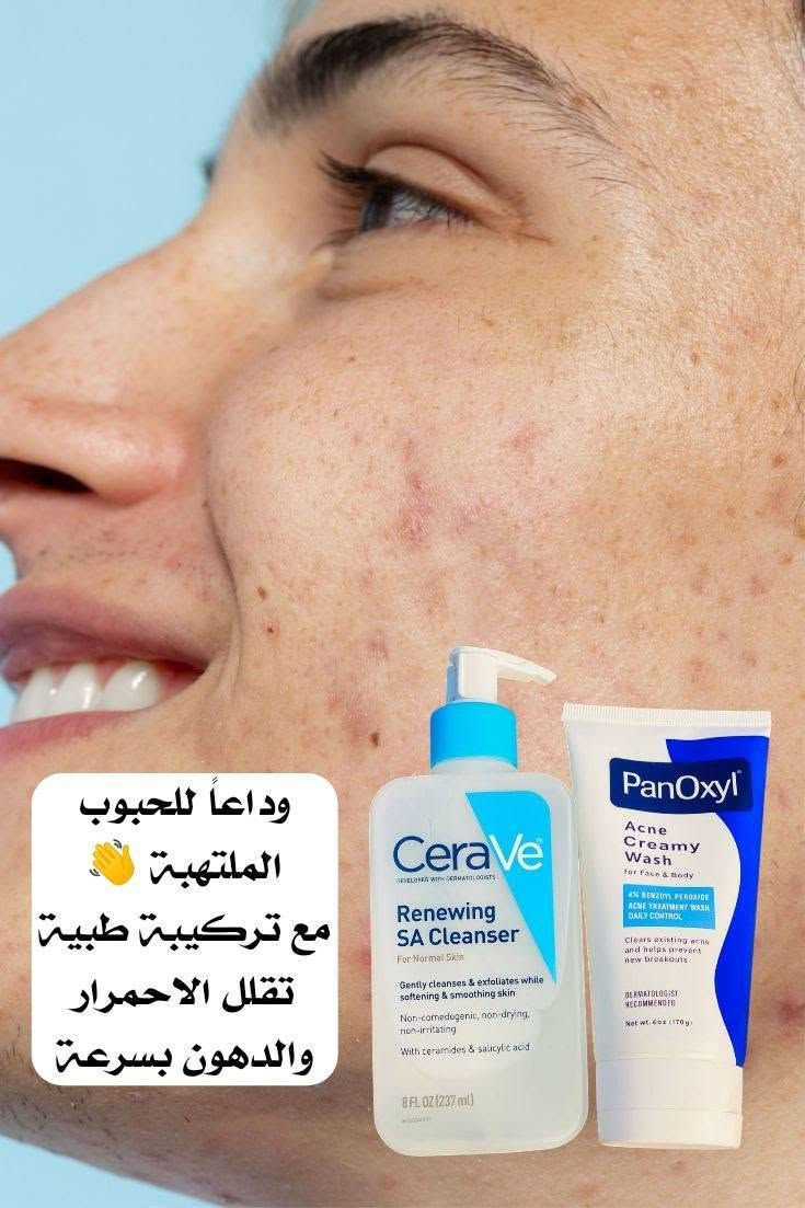 طريقة الاستخدام عرض للحبوب ✨
🔹 الصبح يومياً ☀️
غسول CeraVe 
تنظيف خفيف وتقشير لطيف

🔹 الليل 🌙
غسول PanOxyl 
✔️ بالبداية: يوم اي ويوم لا (حتى ما يسبب جفاف)
✔️ بعد ما تتعود البشرة: ممكن يومياً
⏳ يترك 1–2 دقيقة وبعدين ينغسل
(حتى يقتل البكتيريا ويساعد على علاج الحبوب) 
PanOxyl

🔹 مهم:
مرطب + واقي شمس ☀️


**إذا كنت صاحب هذا الإعلان وتريد حذفه لأي سبب، رجاءا أرسل رسالة إلى الدعم الفني**