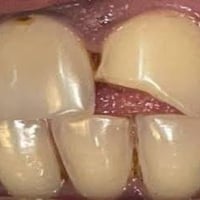 خدمات مجانية • قلع أسنان • جامعة أهل البيت