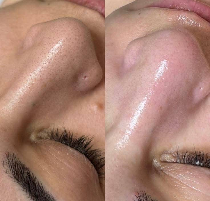 عرض لمده اسبوع لحكو 😍💅🏻
اكرلك مع دزاين اضفرين 12 الف وضمان الاكرلك شهر

والرموش تبقى من اسبوع لحد 25 يوم بس بـ4 الف 😎

الحسينيه السوق الاول شارع الشريفي

***********
