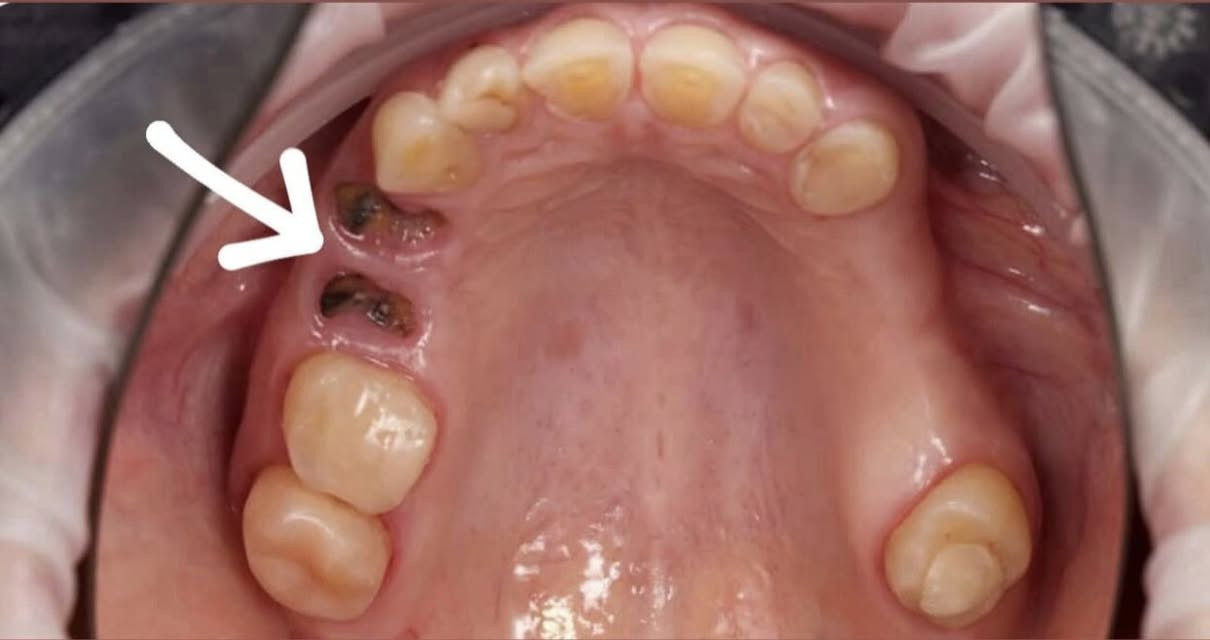 السلام عليكم 
متوفر علاج مجاني من تنظيف الاسنان او حشوه ضوئيه للاسنان المتسوسه وقلع للجذور المتبقيه وطقم اسنان 
الموقع عيادات جامعة الفراهيدي
للتواصل ***********
