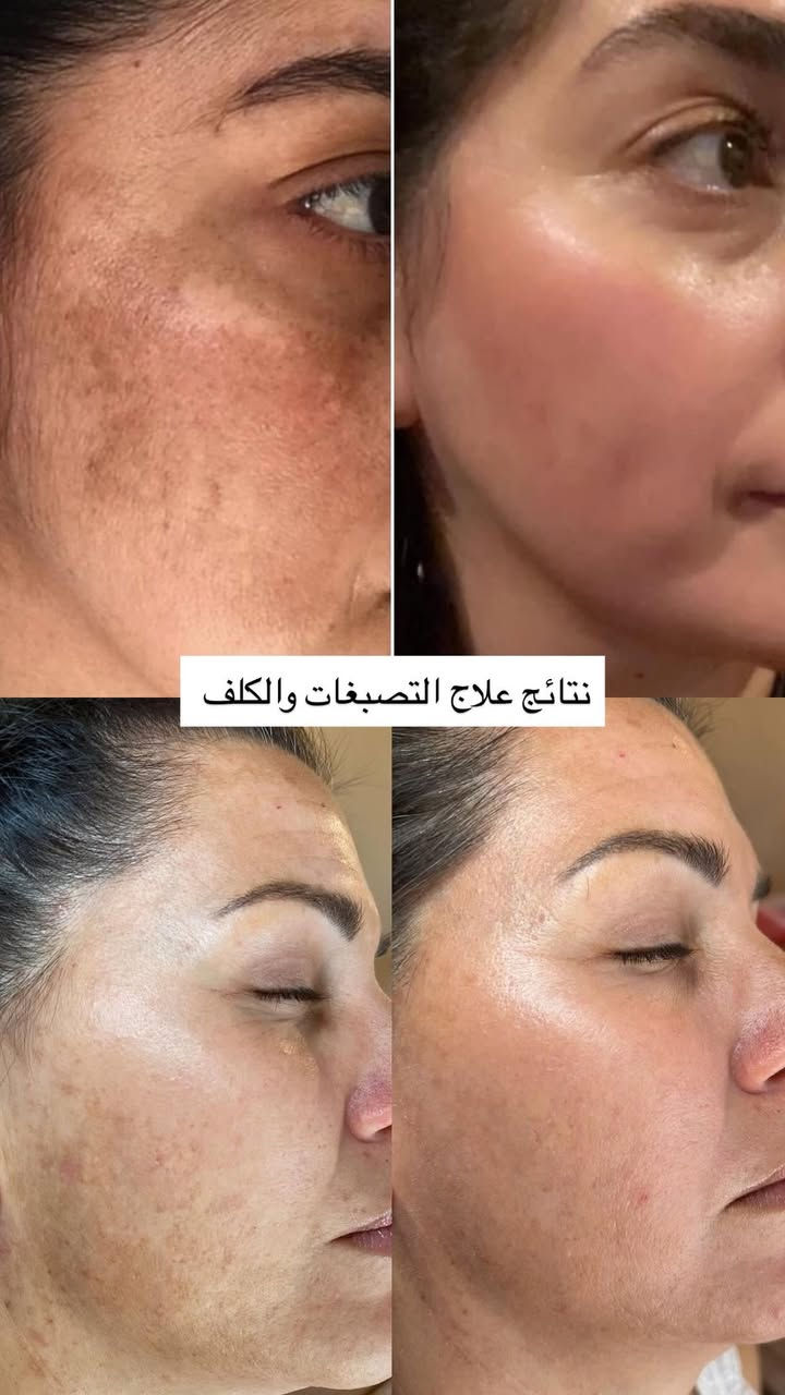 استغلوا العروض 
الموقع/ زيونة 710 خدمي دريم ستي 
للاستفسار/ ***********
