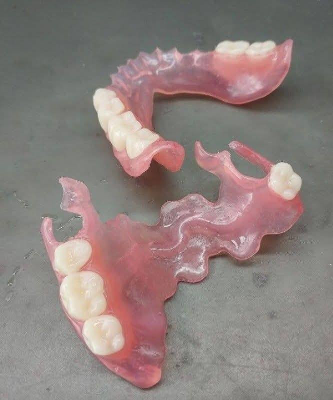 مجاناً🔴🔴 
 ♕حشوات ظوئية تجميلية وازالة التسوس
♕ قلع الاسنان والجذور المتبقية
♕تنظيف الاسنان وإزالة التكلسات الموجودة
♕طقم جزئي متحرك لتعويض الأسنان المفقودة  
للحجز والاستفسار: ***********
كربلاء _السعدية _خلف مول الحارث
