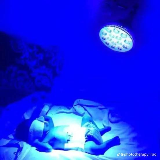 طفلك بيه ابو صفار ونسبتة صاعده ومحتار بدخوليته للمستشفئ  صار يمنه لمبات خاصه ب ابو صفار وانت ببيتك مجرد تخلي الطفل تحت الاضائة الموجية وخلال يومين راح يتعافئ وتنزل النسبة 
كل ماعليك هوا الاتصال بالارقام او مراسلتي خاص  وننطيك كافة المعلومات والتفاصيل
***********
‏‪***********‬‏
