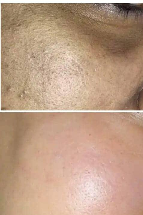 جلسات شد البشره وازاله التصبغات
بتقنية جديده 
للحجز او الاستفسار واتس
***********
