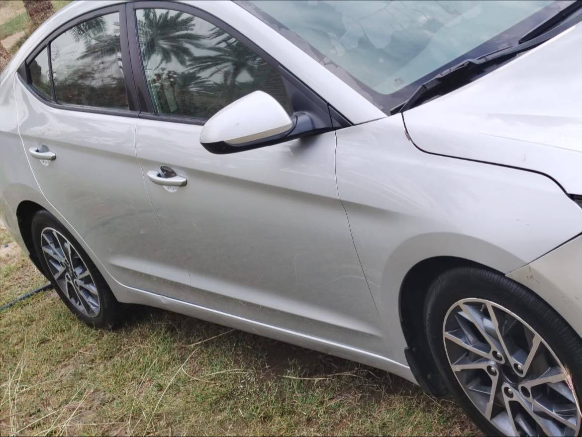 الانترئ ٢٠٢٠ كير اي تي محرك ٢٠٠٠ وارد امريكي معوقين رقم كربلاء حادثها فقط بنيد ومصلح نفسه الرقم للاتصال خاص ممتواجد
***********
