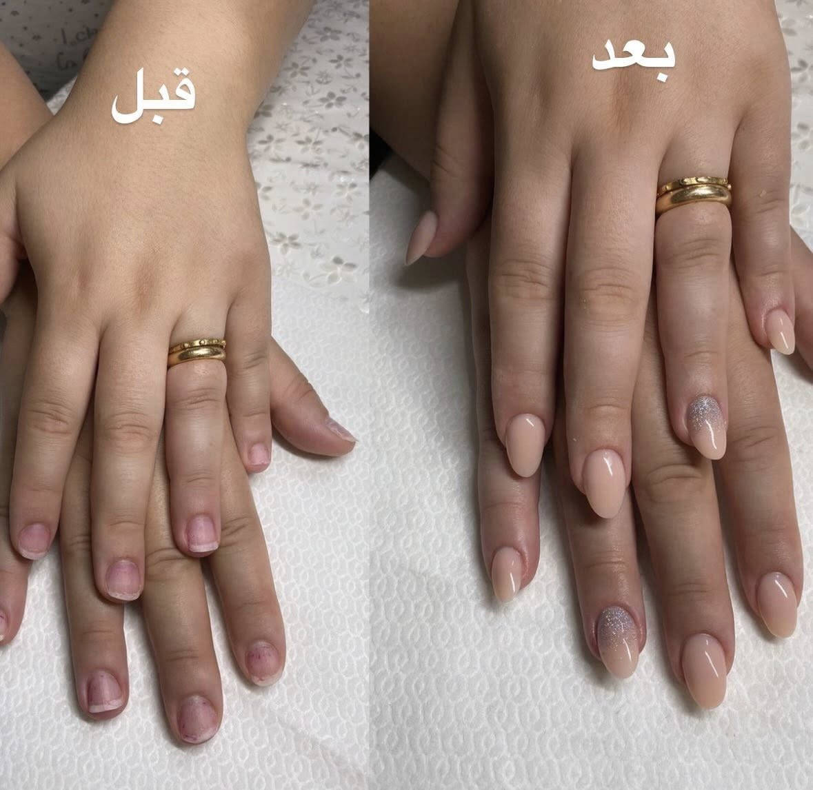 استقبلي العيد بأجمل اطلالة مع عروضنا الخاصة

جل اكستيشن ب 20
جل گفر ب 15
سترونك ب 15
جلش فقط ب 10
جلش مع دزاين ب 15
ازالة ب 10
ادامة ب 15


**إذا كنت صاحب هذا الإعلان وتريد حذفه لأي سبب، رجاءا أرسل رسالة إلى الدعم الفني**