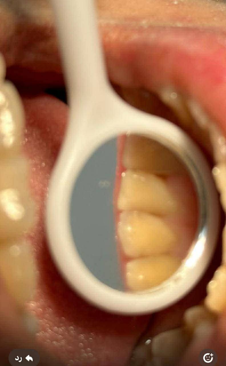نستقبل المرضى في كليه طب الأسنان/شارع الكورنيش
قرب مستشفى الأطفال 
*(العلاج مجانًا بكل تقدير)*
خدماتنا تشمل:
يوم الاربعاء - تنظيف الأسنان.
يوم الخميس- تركيب الحشوات.
يوم الاحد - قلع الأسنان.

الدكتور يوسف ادهم    
للحجز والاستفسار:  
📞***********
