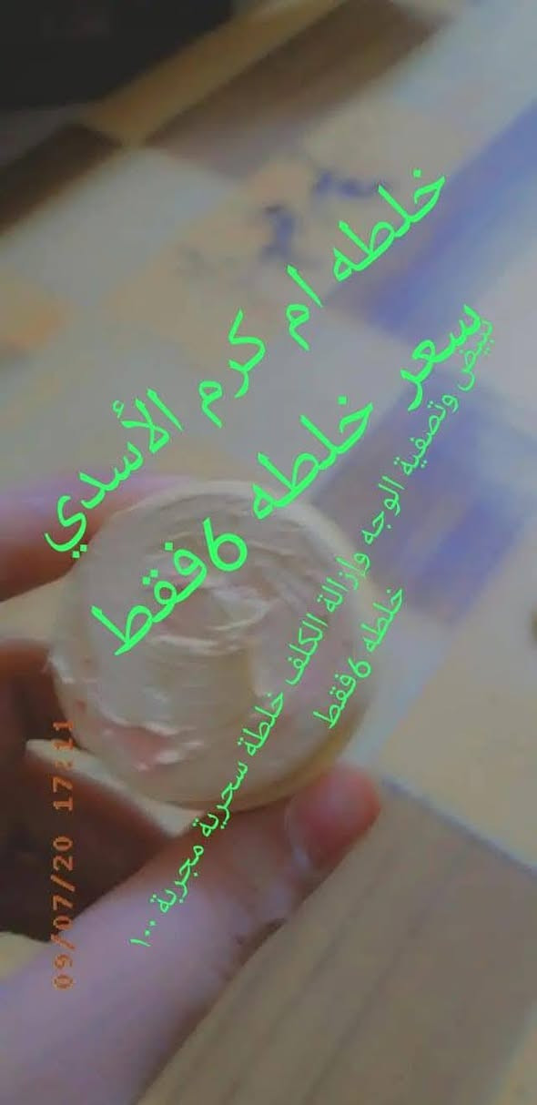 ساارعو بل حجز بنات وجهج بل عيد يصير كزازه الله شاهد عليه جنن  اكيد وجهج تعبانه هذا رمضان شمنتظر احجزي خلطه تسوي وجهج كمير.الخلطات كلف /نمش /حب/اثار حب/تصبغات /تبيض/تسمين/توريد /تجاعيد/خطوط بلوجه/خلطه ركب/ خلطه ايدين/خلطه رجلين/خلطه رقبه/خلطه


**إذا كنت صاحب هذا الإعلان وتريد حذفه لأي سبب، رجاءا أرسل رسالة إلى الدعم الفني**